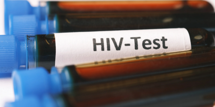 Meningkatnya HIV di Jawa Timur, Jangan Keliru Membaca Akar Masalah